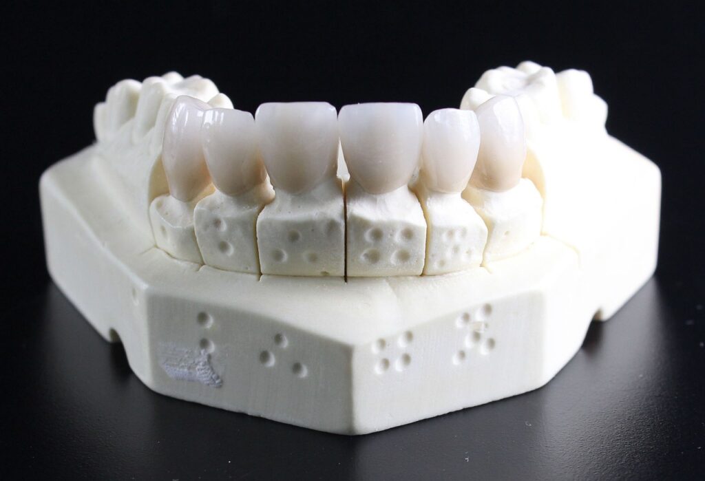 composite dental filling, dentures, teeth, dental technician